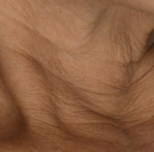 Before/After Image
